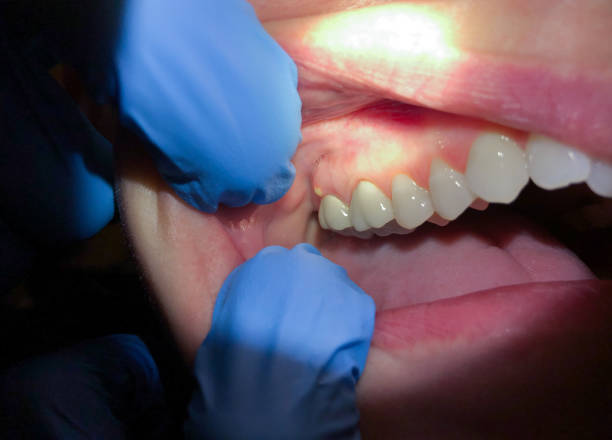 Best Pediatric Emergency Dentist in Woodlyn, PA